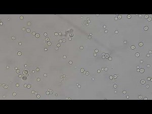 Germ tube, yeast cells and budding yeasts of Candida albicans