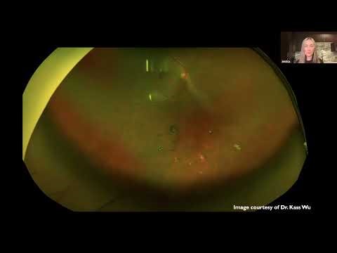 Retinal Pathology to Retinal Practice