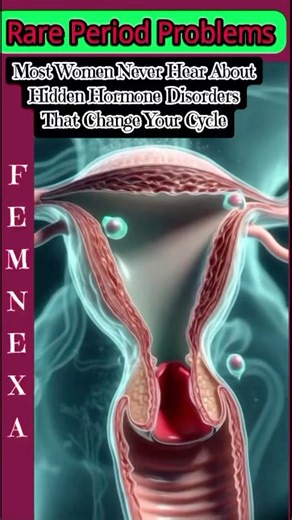 Rare Menstrual Disorders Doctors Warn About