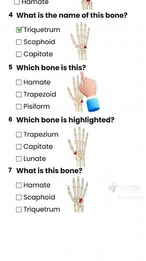Wrist Bones Quiz: Test Your Knowledge!