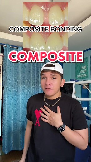 COMPOSITE BONDING #docjohnthedentist #EDUWOW #LearnItOnTikTok