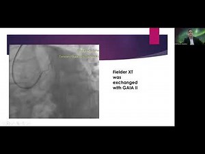 Session 3: Antegrade CTO Case based approach
