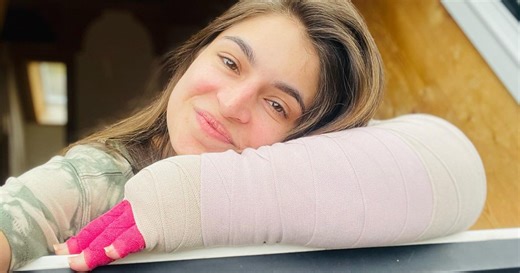 Woman, 36, uses viral videos to share what people get wrong about lymphedema