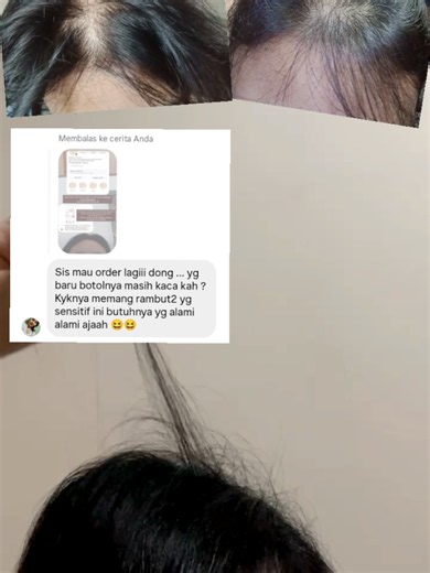 Hair Oil untuk Rambut Rontok: Pilihan Alami yang Tumbuhnya Numbuh