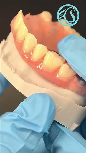 Replacing Missing Teeth With Valplast Partial Denture. #dentist #dentallab