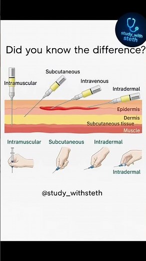 Injection Types & Angles Explained in 30 Seconds💉| Must Know for Med Students!"#injectiontypes #mbbs