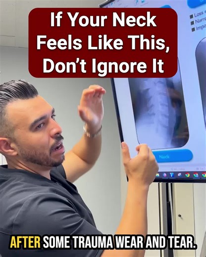If your neck feels stiff, sore in the morning, hard to turn, or comes with tension headaches➡️don’t ignore it. These are often Phase 1 signs of neck degeneration, where the natural curve begins to flatten and disc space starts to change. This is the easiest stage to correct if it’s addressed early. Waiting is what allows it to progress. 👉 Watch the full video to understand what’s happening and why early correction matters. #NeckPain #EarlyWarningSigns #ForwardHeadPosture #DeskJobPain #TensionHe