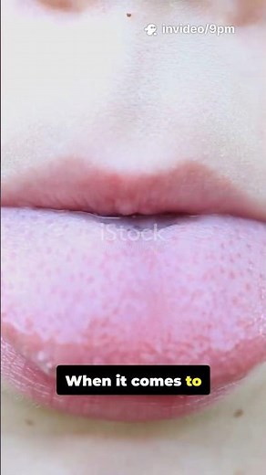 coprolalia - "obsessive use of obscene language, either through mental illness or perversion,"