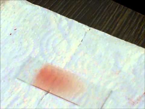 Making a blood smear