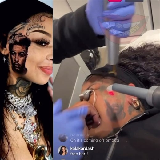 Say Cheese TV 👄🧀 on Instagram: "Chrisean starts laser treatment to remove her tattoo of Blueface from her face"