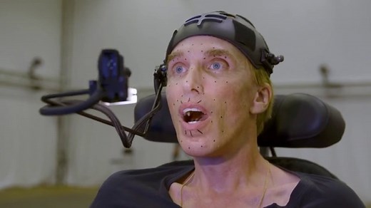 Video: Channel 4's Peter: The Human Cyborg