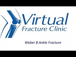 Weber B Fracture