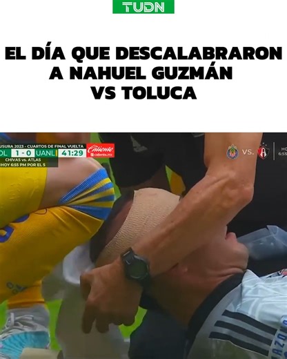 🩸 🤕 ¡Su propio compañero le abrió la cabeza! 😈 Toluca vs Tigres 🐯 🗓️¡HOY! 🇲🇽 ViX, TUDN y Canal 5 | 6:50 PM 🇺🇸 ViX, TUDN USA y Univisión | 6:30P/5:30C/3:30PAC 📲📺¡Disfruta de lo mejor de la Liguilla MX en VIX! 🟠 | TUDN USA