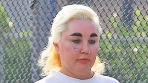 Amanda Bynes unveils new body modification after fillers and Ozempic