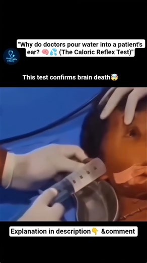 The Caloric Reflex Test Explained (Brainstem Assessment) 🧠