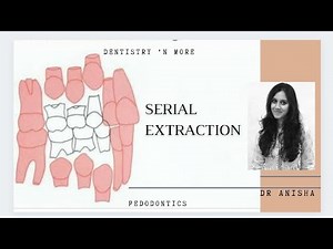 SERIAL EXTRACTION
