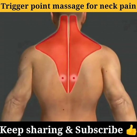trigger point massage for neck pain #animation #bodyinsight