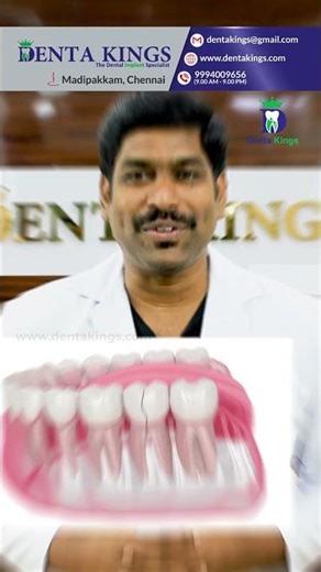 வேர் சிகிச்சை செய்த பல்லுக்கு தொப்பி போடுவது ஏன்? - Why Cap for Root Canal Treated Tooth