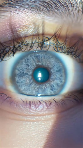 The eye color change with laser is a progressive and completely safe process that works by gently removing the superficial pigment of the iris. 🌈 Session by session, the color gradually lightens in a natural way, until reaching the desired tone, with no surgery or implants needed. In this case: from a grade 5 brown to a bright sky blue 👁️ ✨ Want to know more?�Visit www.eyecos.eu or come see us at Av. Diagonal 415, 1st floor, Barcelona📍 #eyecos #eyecosclinic #barcelona #eyecolorchange #laserir