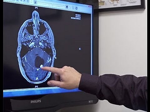 Hemangioblastoma in the Brain with Neurosurgeon Dr. Jeffrey Cattorini