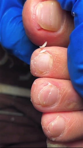 Gentle Pedicure Care | Clean Toenail Trim #fypシ #cleannails #satisfying