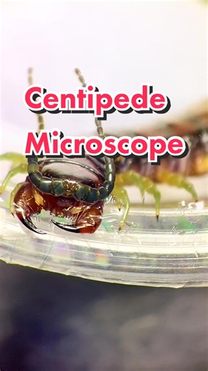 Exploring Bugs Under the Microscope in Australia