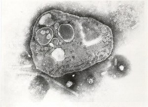 Rinderpest - Alchetron, The Free Social Encyclopedia