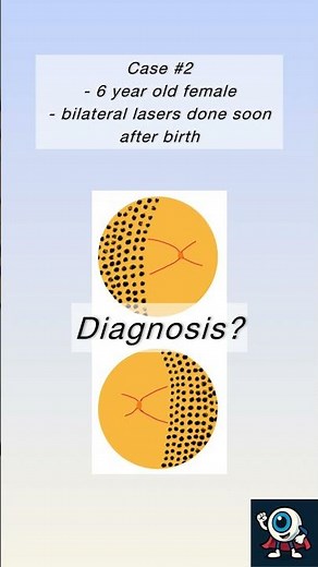 Laser Patterns & Differentials: A Quick Visual Guide 👀⚡
