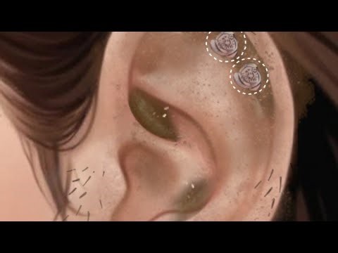 Ear Cleaning ASMR 👂 | Satisfying Ear Wax Removal Sounds | Deep Sleep & Relaxing Triggers