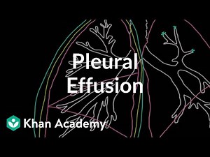 What is a pleural effusion? | Respiratory system diseases | NCLEX-RN | Khan Academy