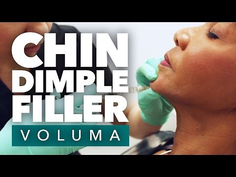 Cleft Chin Dermal Filler | Chin Dimple Filler | Los Angeles