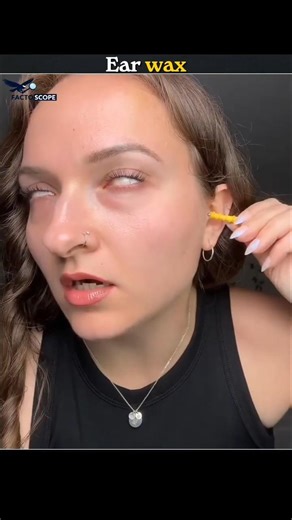Don't use cotton swabs😰 || #shorts