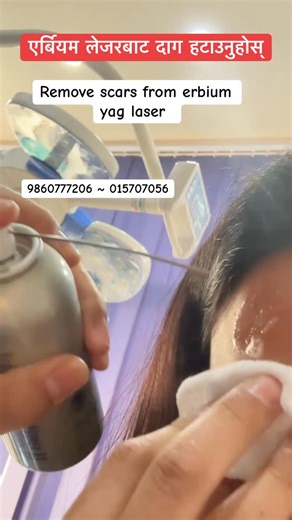 Suyog Mainali on Instagram: "We are located at Kathmandu Anamnagar near bajeko sekuwa and bouddha opposite to taragaoun museum please contact at:9860777206/01-5707056 9768912947 / 9768912948 or you may find our exact location at google maps. We provide various injectable, laser as well as surgical treatments including hair transplant/ beard transplant/eyebrow transplant and many more…#drmainali #kccsdermatology #kccs #skincare #scars"