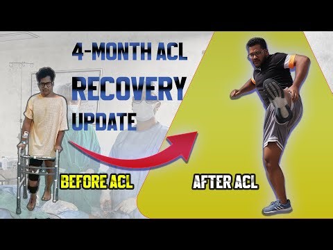 ACL Recovery Journey | 4 Months Post Surgery | Q&A + Comeback Tips