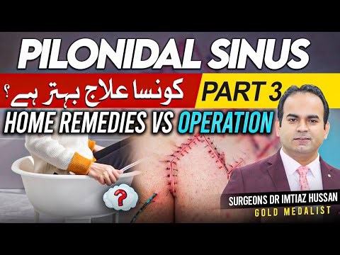 Home Remedies or Surgery of Pilonidal Sinus | Part 3 | घरेलू उपचार या सर्जरी | Which is Best?