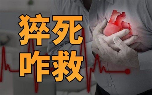 聊聊猝死的AED急救，知道这些或许能救命