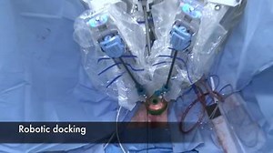 Robotics and the Perineal Approach to Radical Prostatectomy