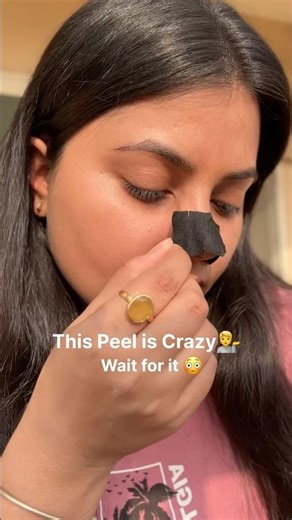 Sirona Nose Strip TRY & REVIEW 💗 Unsponsored!