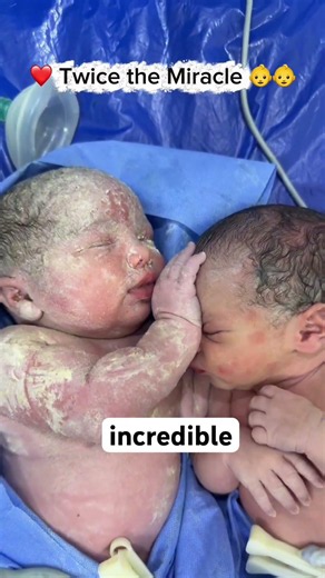 Twins Meet the World Together for the First Time ❤️👶👶