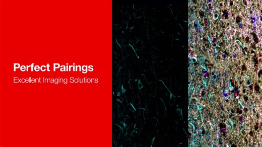 易 Identify and analyze neurons with precision. MAP2 antibody...