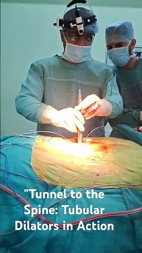 "Step-by-Step: Tubular Dilators to MIS Retractor in Spine Surgery" #hospital #minimallyinvasive