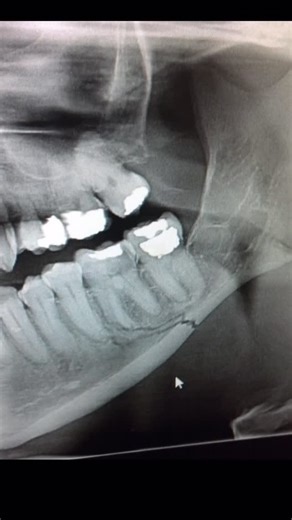 theZEV🎶 on Instagram: "ystoi nuurguil bolloodoo eruu huga 😬"