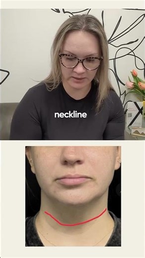 The platysma is a thin neck muscle that can start pulling your face down.