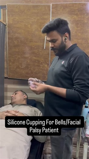 Dr-Hanan Abdullah on Instagram: "Using silicone cups for “moveable” (gliding) facial cupping is a popular supportive therapy for Bell’s Palsy. It uses gentle suction to stimulate blood flow and nerves without the harshness of traditional stationary cupping. How it Helps Bell’s Palsy Nerve Stimulation: The gentle “pulling” sensation of the cup helps stimulate the peripheral nerves that have become dormant or “stuck” due to inflammation. Blood Circulation: It brings fresh, oxygen-rich blood to the