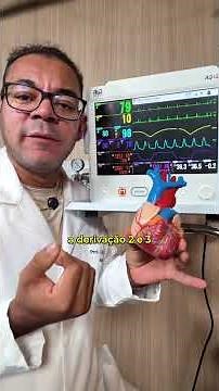 ECG: Leads D1 and D2