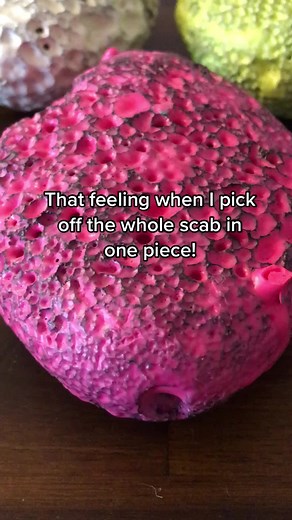 Healing Scabs: Tips and Tricks for Skin Picking Recovery