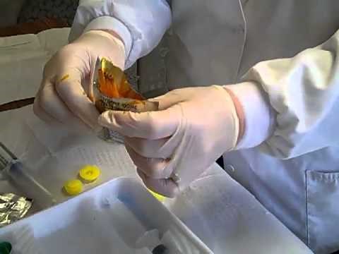 Use of Lidocaine Jelly for Foley Catheter Insertion 2012