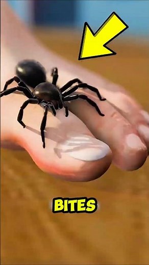 Don’t Do THIS After a Spider Bite — It Could Save Your Life!” 😱🚨