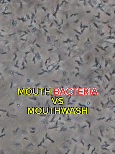 Bacteria Experiment with Mouthwash Under Microscope
