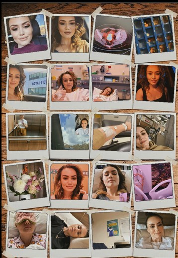 My Cervical Cancer Journey: A Fighter's Story